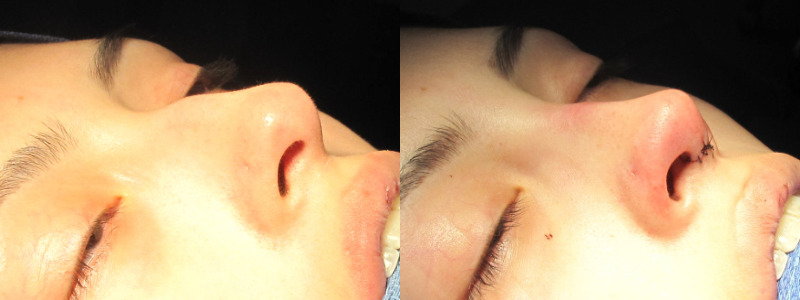 Patient 38 Combined Image