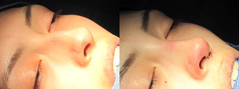 Patient 38 Combined Image