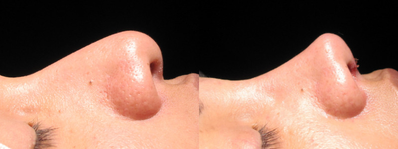 Patient 5 Combined Image