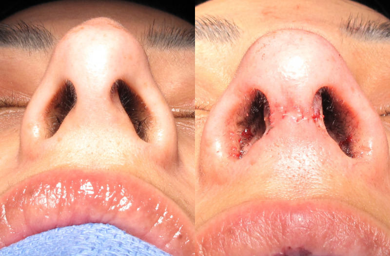 Patient 10 Combined Image