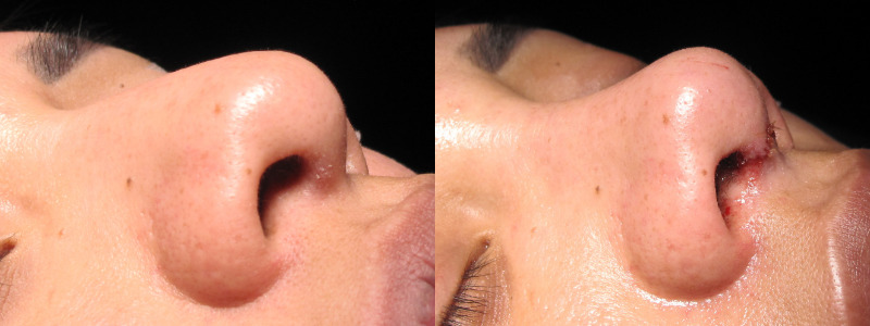 Patient 5 Combined Image