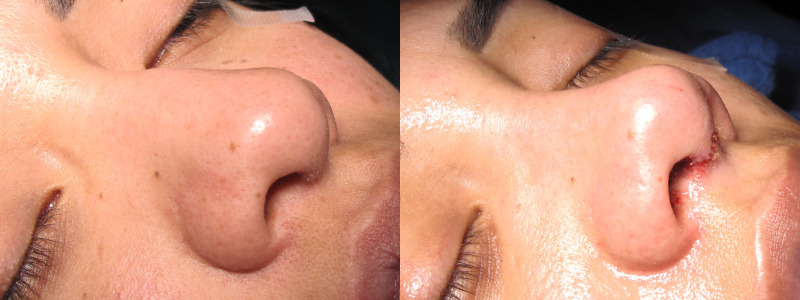 Patient 5 Combined Image