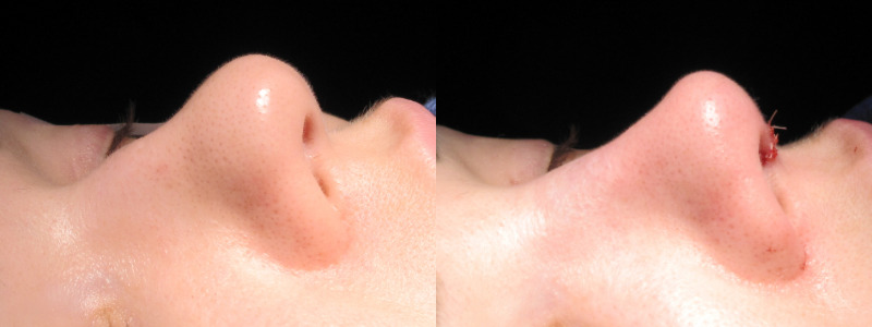 Patient 6 Combined Image