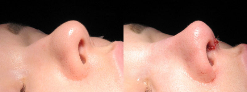 Patient 6 Combined Image