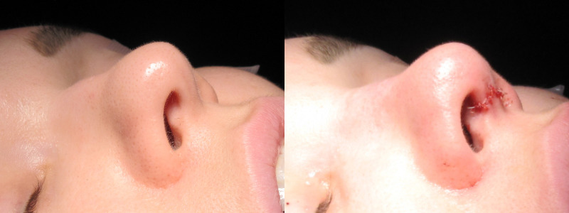 Patient 6 Combined Image