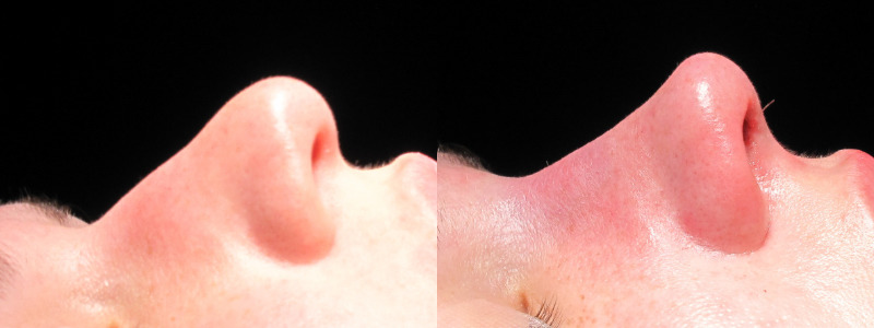 Patient 7 Combined Image