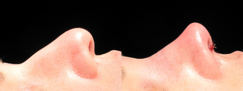 Patient 8 Combined Image