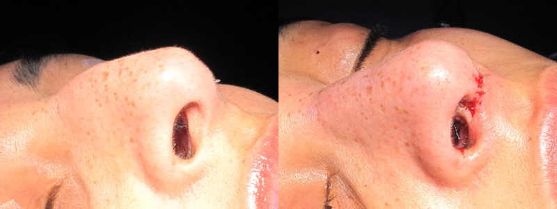 Patient 10 Combined Image