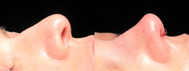 Patient 8 Combined Image