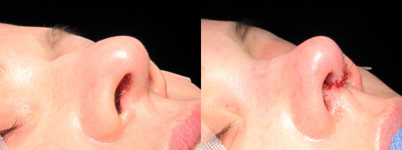 Patient 8 Combined Image