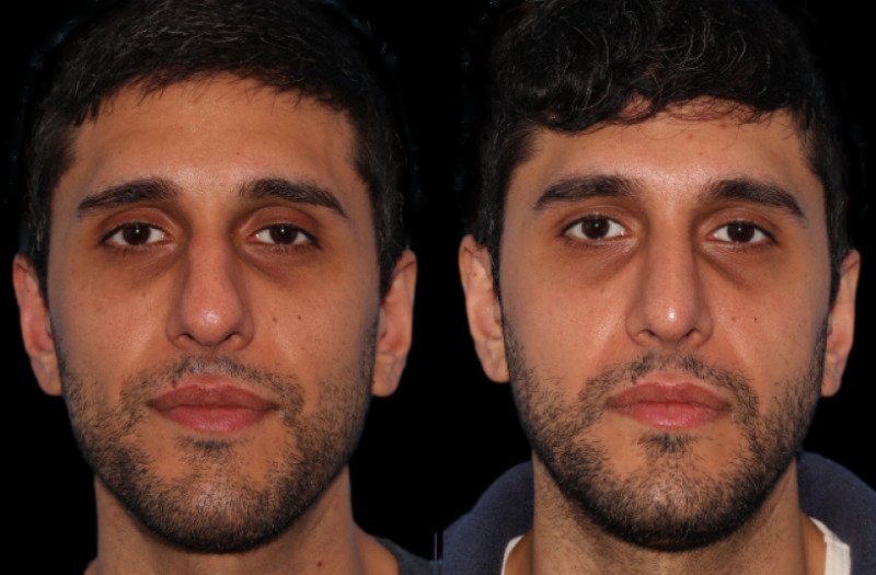 Patient 14 Combined Image