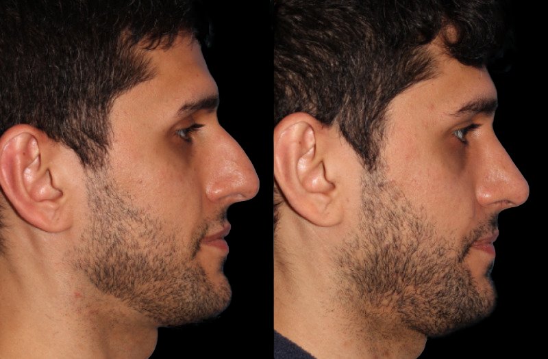 Patient 14 Combined Image