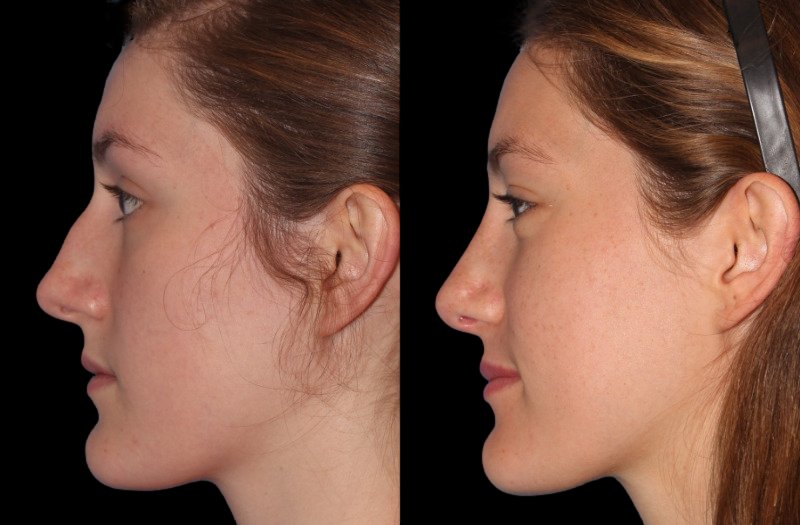 Patient 23 Combined Image