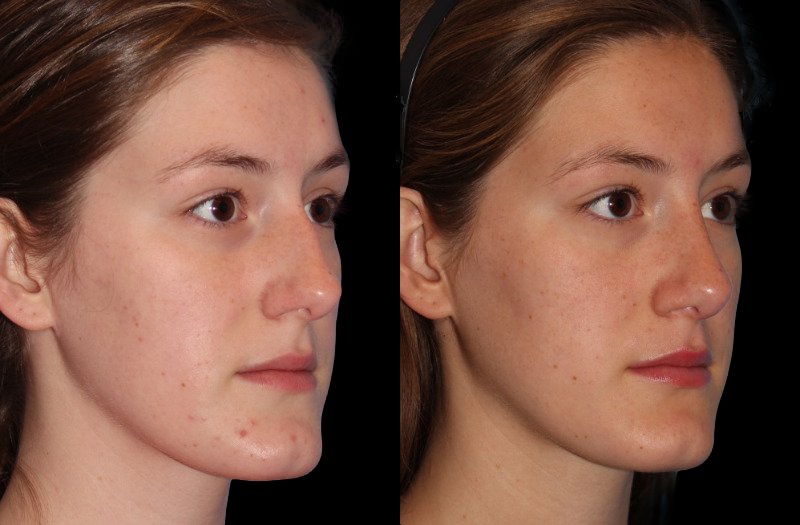 Patient 23 Combined Image