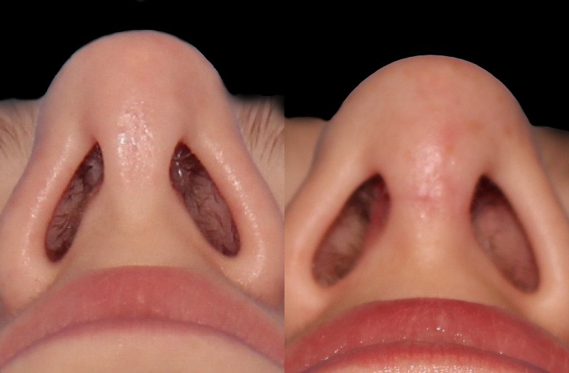 Patient 23 Combined Image