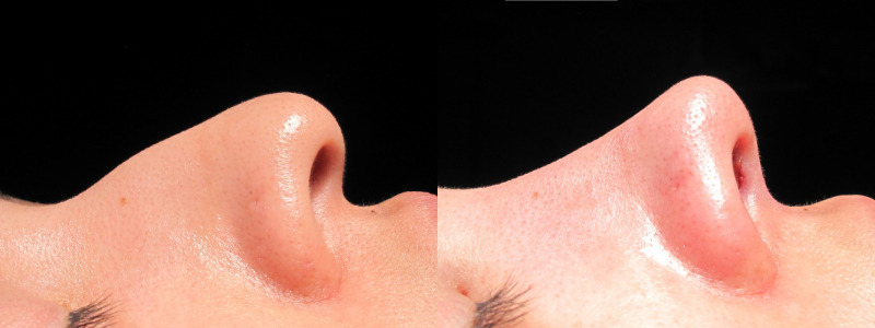 Patient 13 Combined Image