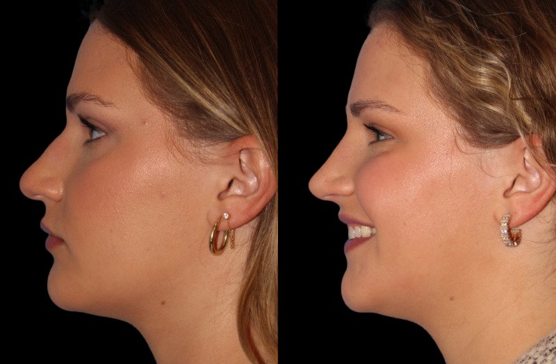 Patient 32 Combined Image