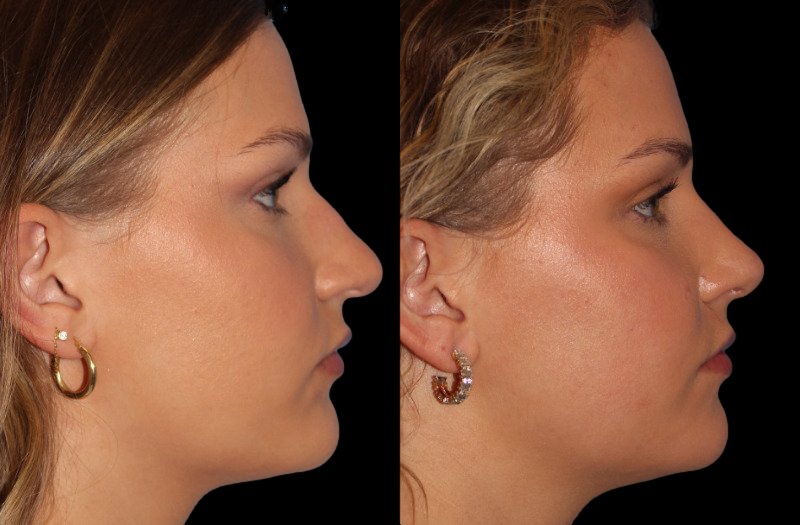 Patient 32 Combined Image