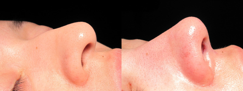 Patient 13 Combined Image