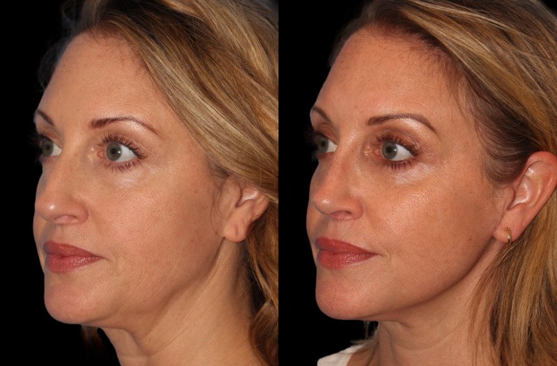 Patient 8 Combined Image