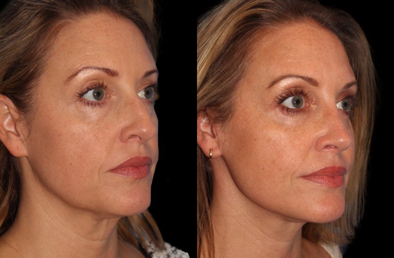 Patient 8 Combined Image