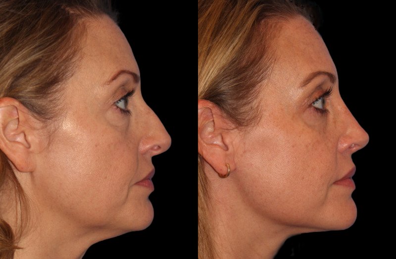 Patient 8 Combined Image