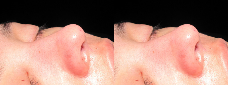 Patient 13 Combined Image