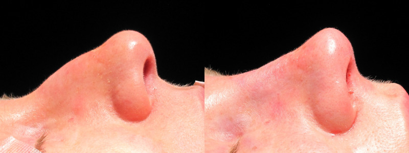 Patient 1 Combined Image