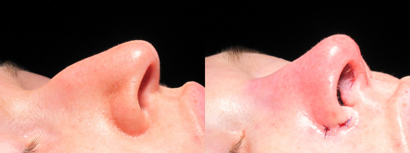 Patient 17 Combined Image