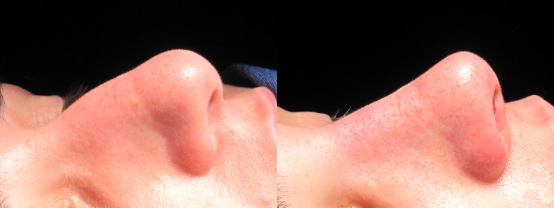 Patient 26 Combined Image