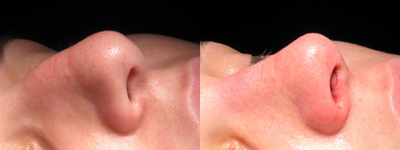 Patient 26 Combined Image