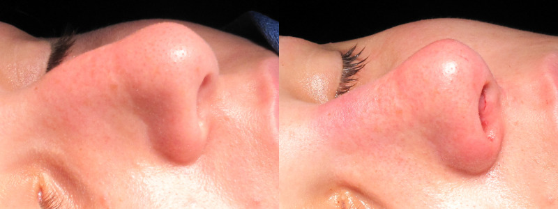 Patient 26 Combined Image