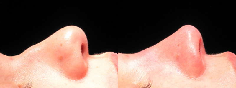 Patient 29 Combined Image