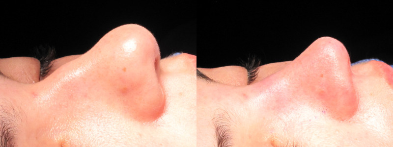 Patient 29 Combined Image