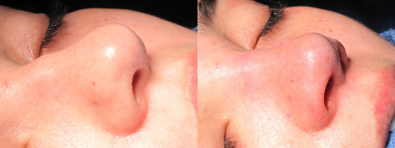 Patient 29 Combined Image