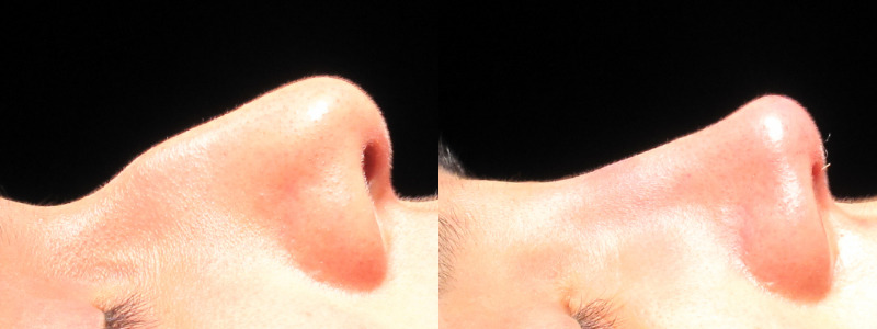 Patient 30 Combined Image