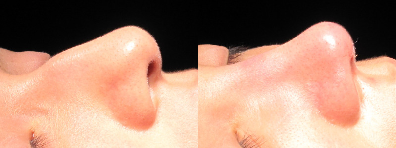 Patient 30 Combined Image