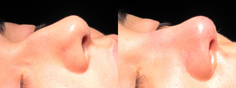 Patient 30 Combined Image