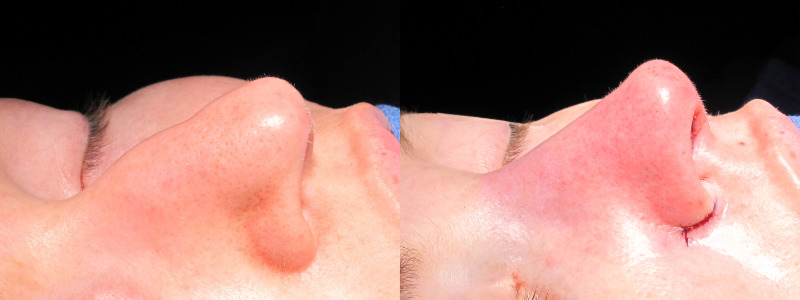 Patient 17 Combined Image