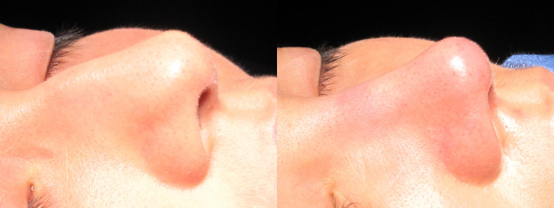 Patient 30 Combined Image