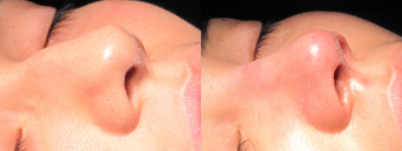 Patient 30 Combined Image