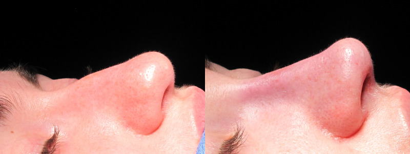 Patient 31 Combined Image