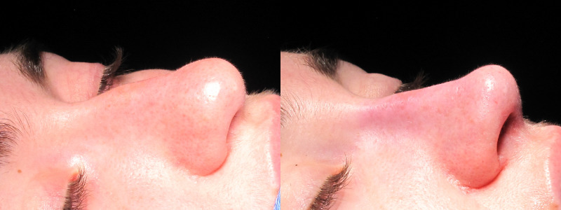 Patient 31 Combined Image