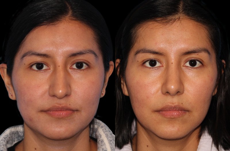 Patient 21 Combined Image
