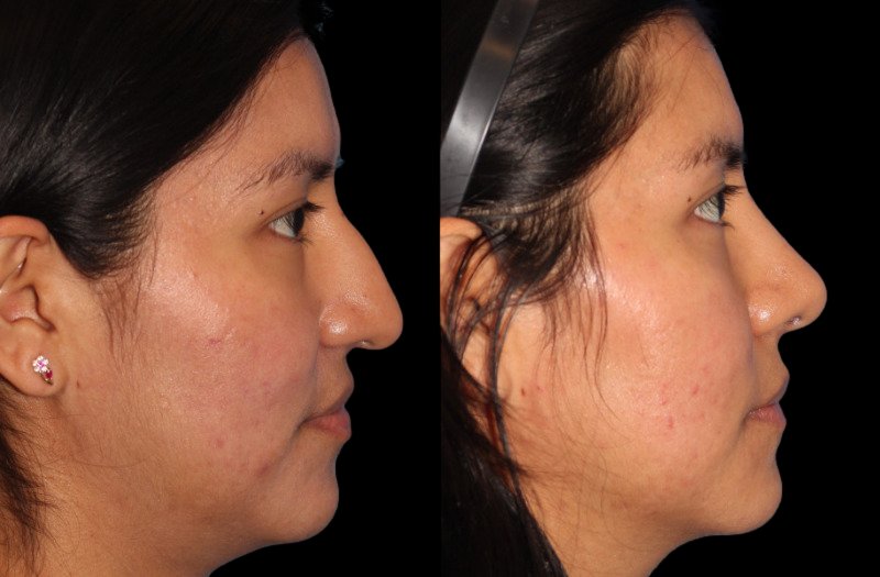 Patient 21 Combined Image