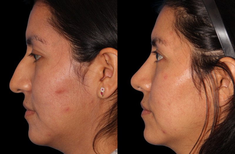 Patient 21 Combined Image