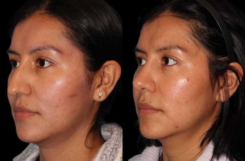 Patient 21 Combined Image