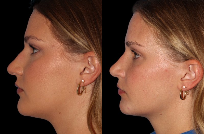 Patient 34 Combined Image