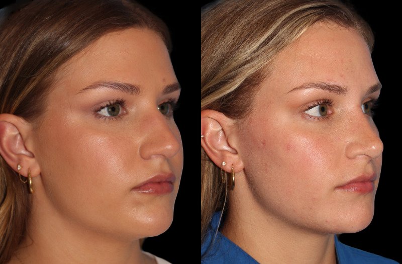 Patient 34 Combined Image