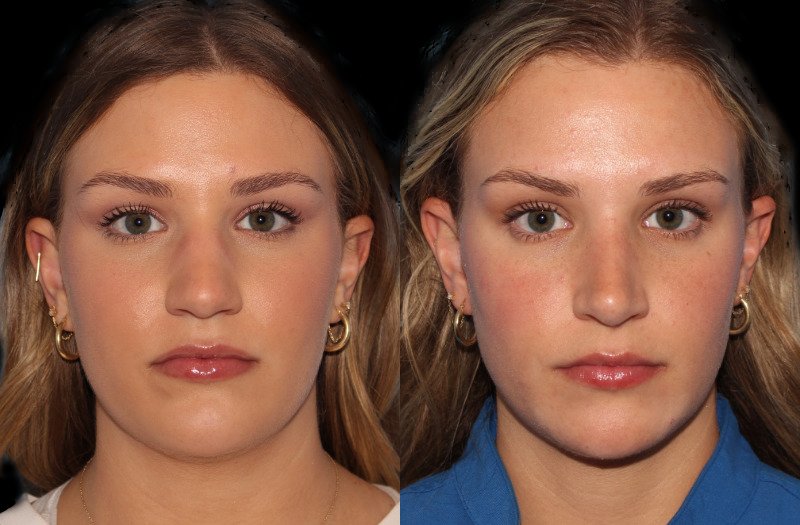 Patient 34 Combined Image